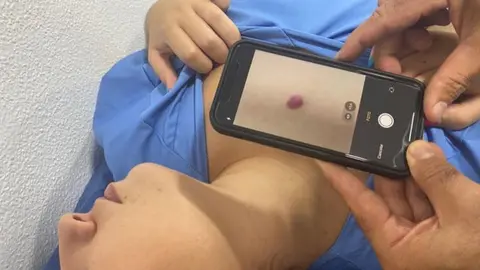 La aplicaci&oacute;n indica, con una fotograf&iacute;a de la lesi&oacute;n cut&aacute;nea,&nbsp;si la lesi&oacute;n es maligna o benigna.