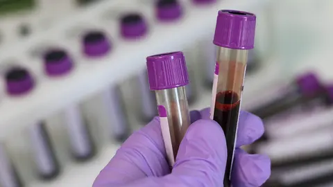 Las farmac&eacute;uticas indias se posicionan en el mercado ruso.